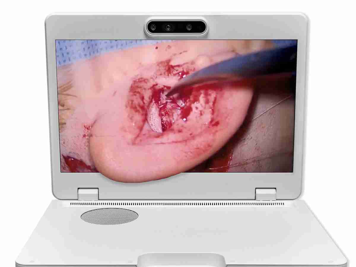 达擎之＂Heads-up 3D显微手术显示系统＂，，，，整合4K裸眼3D显示及眼球追踪系统，，，，具备快速追踪人眼移动位置功能，，减轻医师长时间维持固定姿势的负担，，，让医师能有更宽广清晰的3D立体视野及更舒适的姿势来执行手术。。